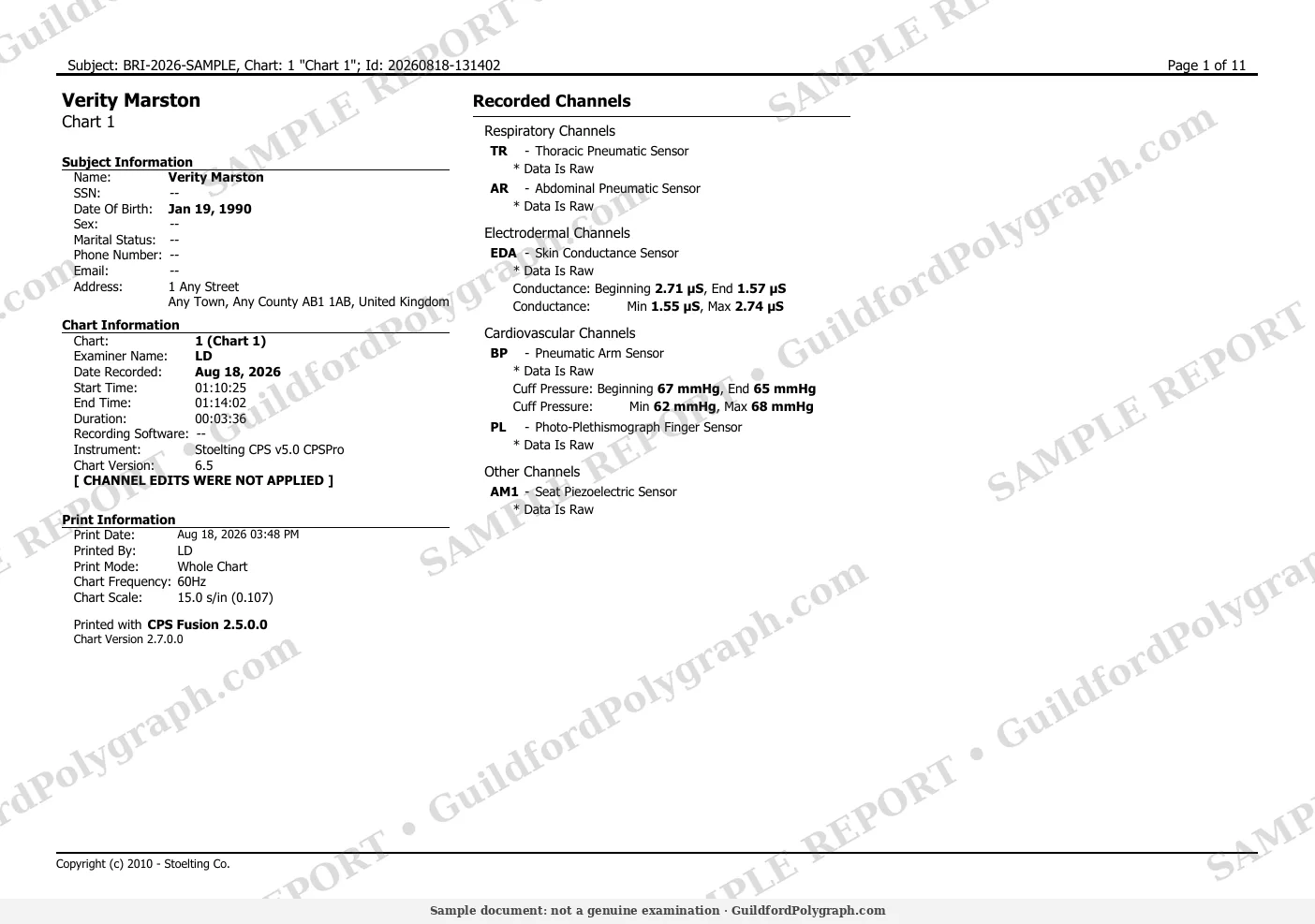 charts page 1 (sample, watermarked)